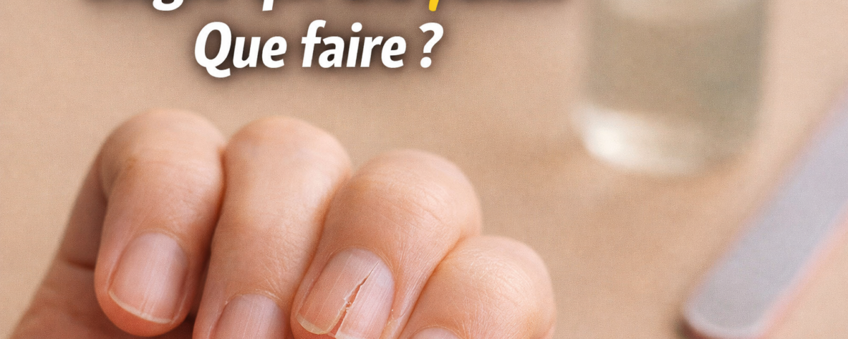 ongle qui se fend que faire fissure ongle naturel solution reparer ongle fendu