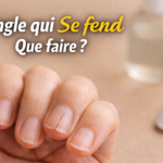 ongle qui se fend que faire fissure ongle naturel solution reparer ongle fendu